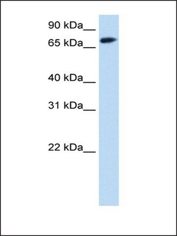 Anti-FOXO1 (AB1) antibody produced in rabbit