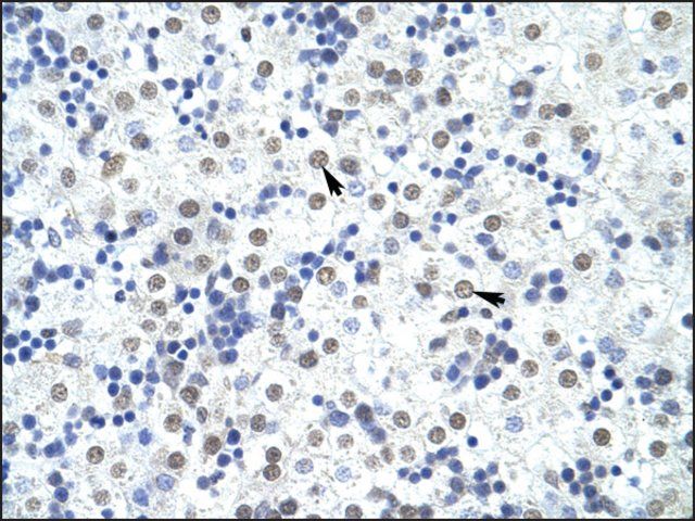 Anti-FOXP4 (AB1) antibody produced in rabbit