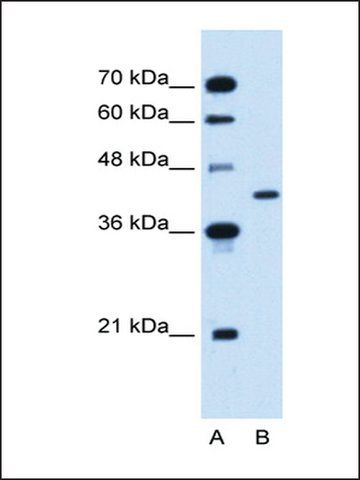 Anti-GOT2 (AB1) antibody produced in rabbit