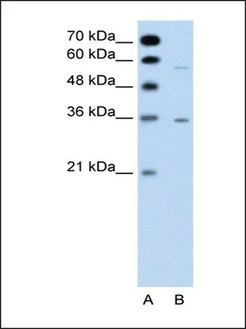 Anti-GPCR5A antibody produced in rabbit