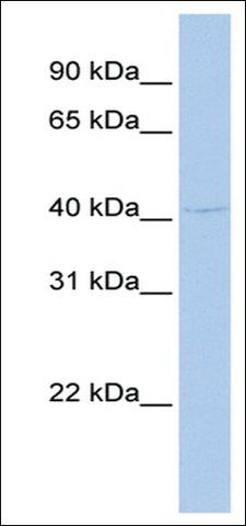 Anti-GFI1 (AB2) antibody produced in rabbit