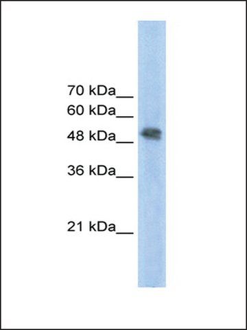 Anti-FECH (Ab2) antibody produced in rabbit