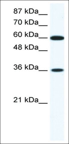 Anti-FOXF1 (AB1) antibody produced in rabbit