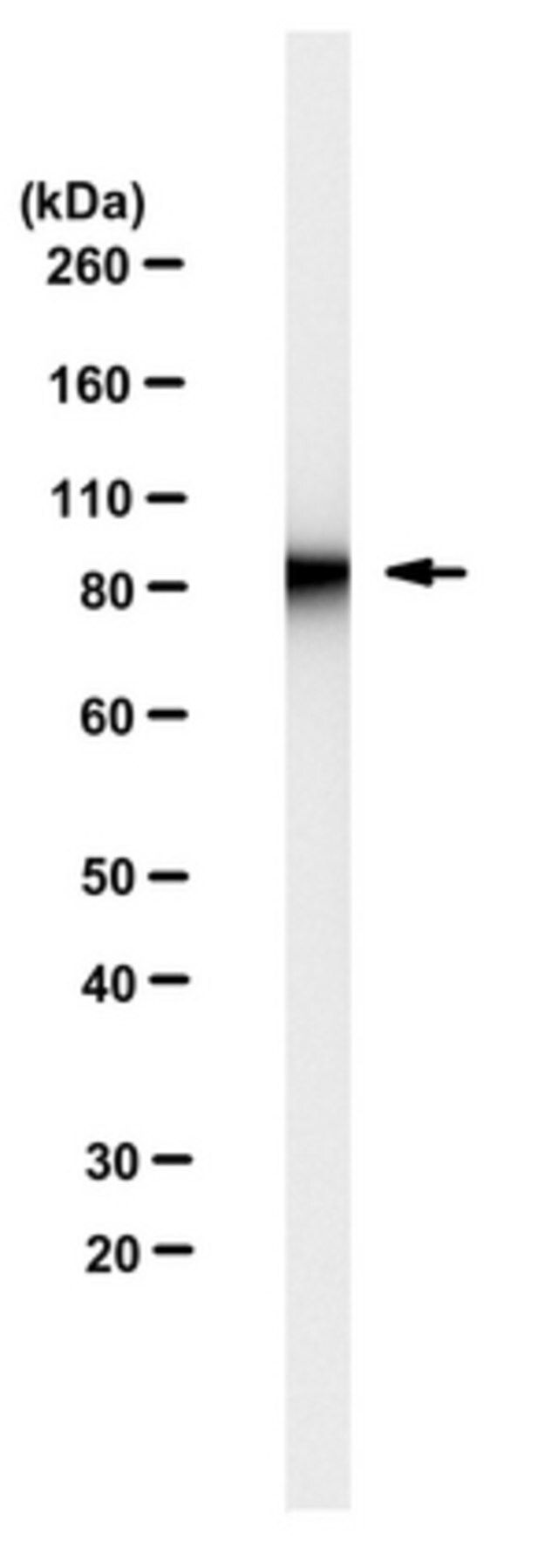 Anti-EWS Antibody, clone 21B1