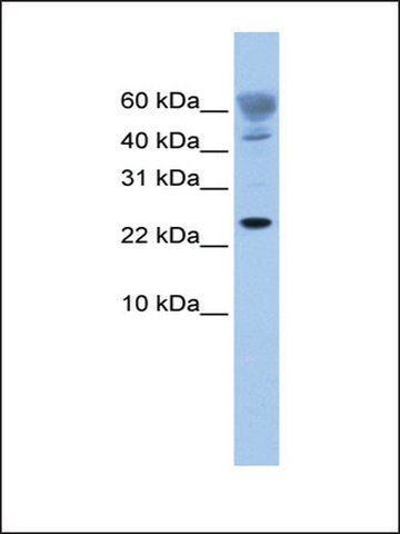 Anti-FUNDC1 (AB2) antibody produced in rabbit