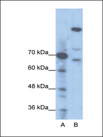 Anti-GLI1 (AB2) antibody produced in rabbit