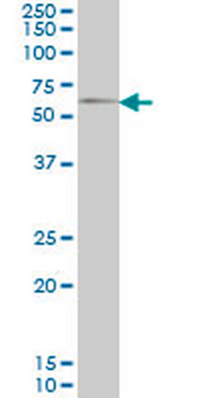 Anti-GGT1 Mouse mAb (1F9)