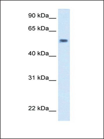 Anti-EXD antibody produced in rabbit