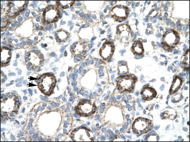Anti-FOXF2 antibody produced in rabbit