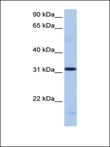 Anti-FUSIP1 (AB2) antibody produced in rabbit
