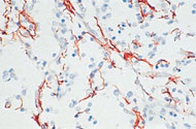 Anti-Glial Fibrillary Acidic Protein Rat mAb (2.2B10)