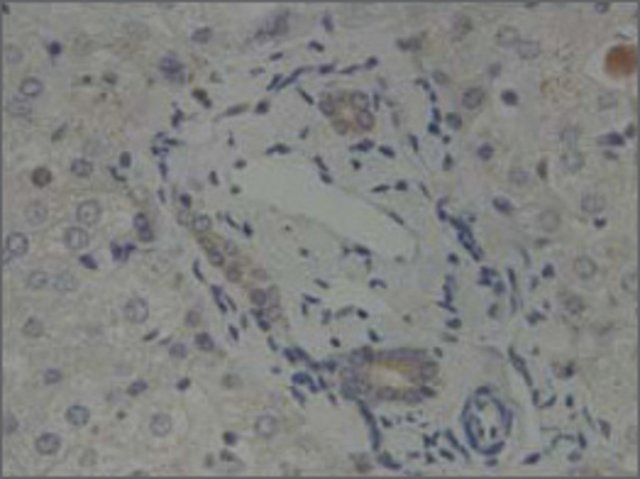 Anti-GLIS2 antibody produced in rabbit