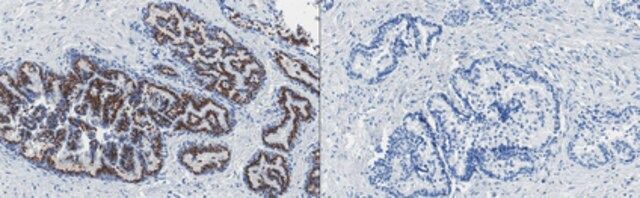 Anti-GOLM1 Antibody, clone 6A2