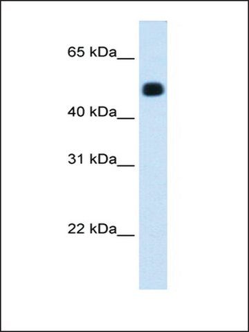 Anti-HMGCS2 (AB2) antibody produced in rabbit