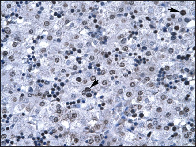 Anti-FOXG1A antibody produced in rabbit