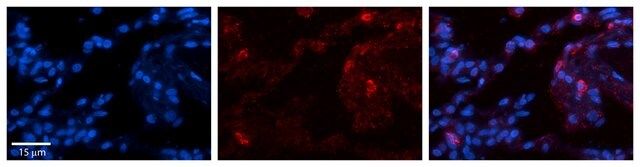 Anti-GPX3 antibody produced in rabbit
