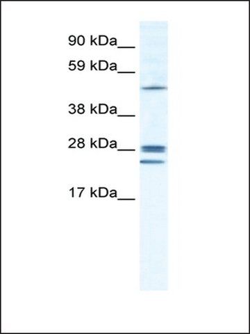 Anti-GJB2 antibody produced in rabbit