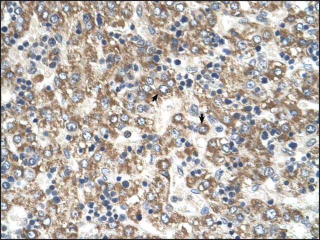 Anti-GOT2 (AB2) antibody produced in rabbit