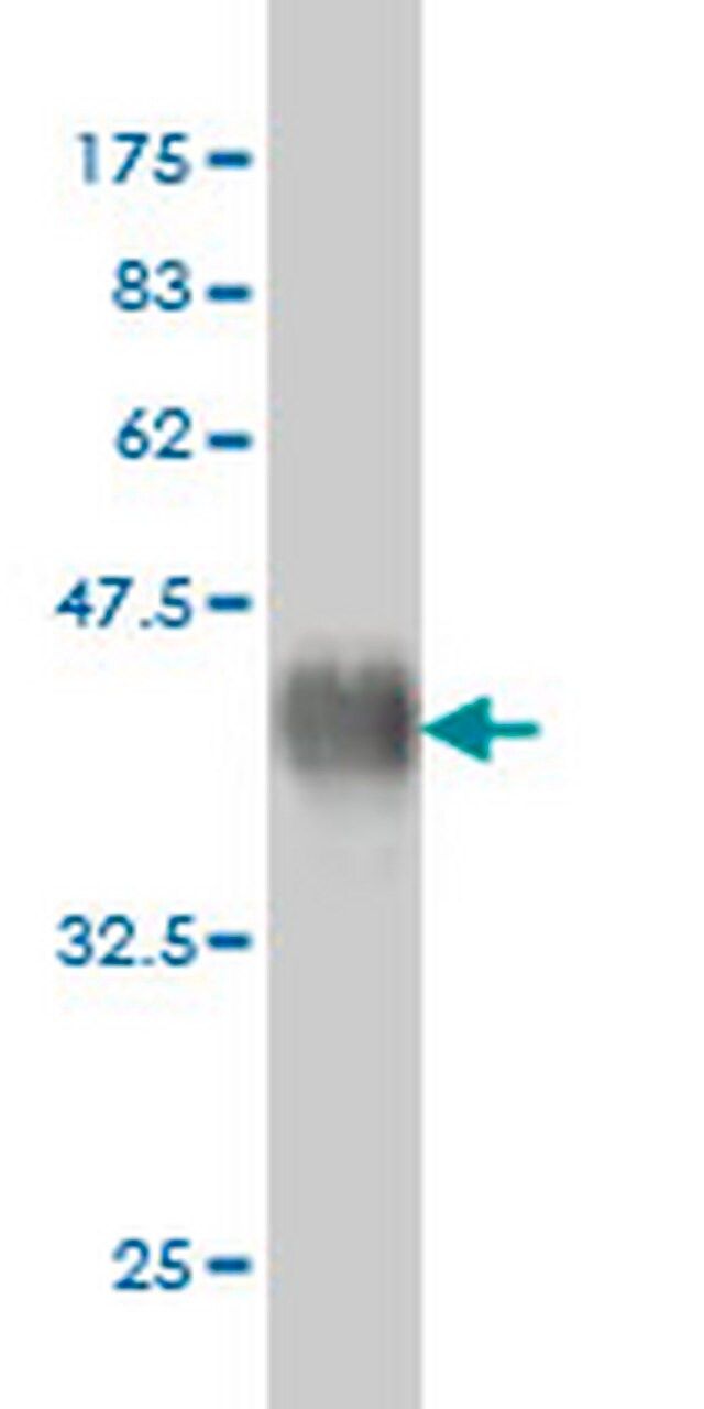 Anti-FGFR2 Mouse mAb (1G3)