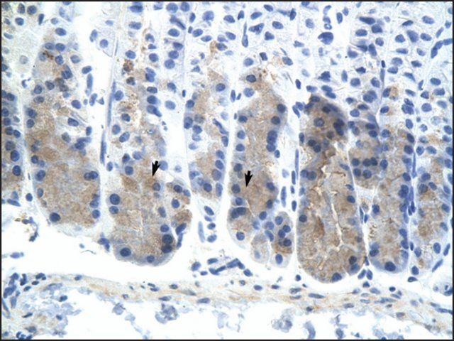 Anti-ELF3 (AB3) antibody produced in rabbit