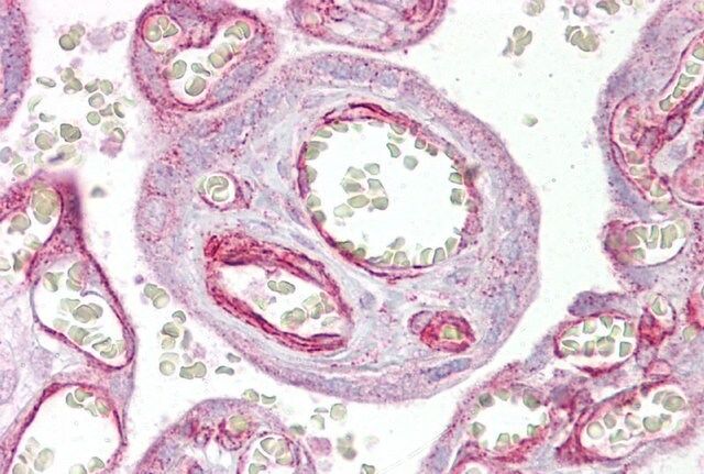Anti-GRHL3 (AB2) antibody produced in rabbit