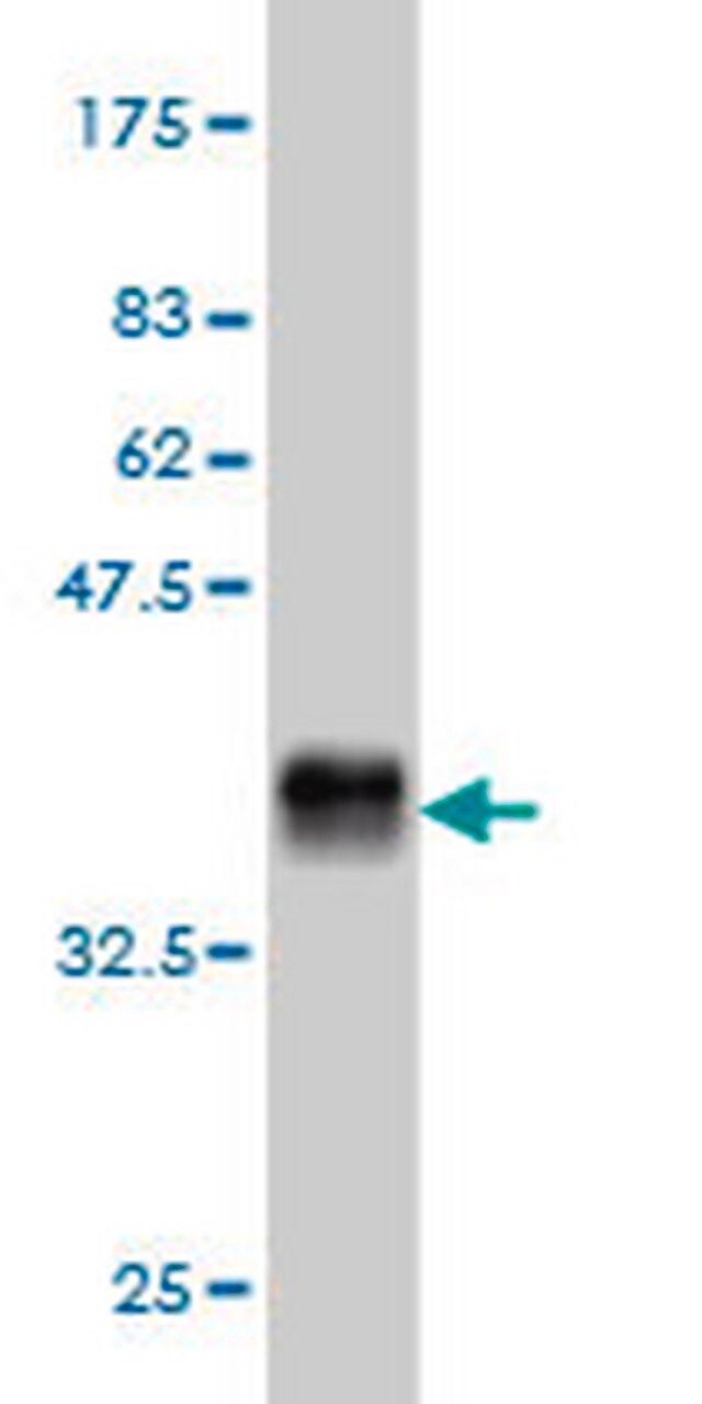 Anti-GHR Mouse mAb (3A12)