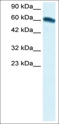 Anti-FOXC2 (AB2) antibody produced in rabbit