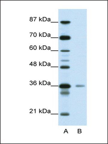 Anti-HMG20A (AB1) antibody produced in rabbit