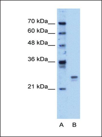 Anti-HMGB1 (AB2) antibody produced in rabbit