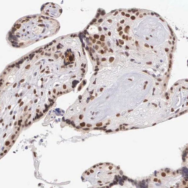Anti-CCDC117 antibody produced in rabbit