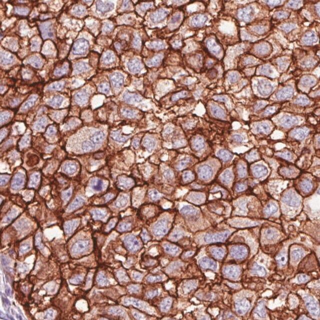 Monoclonal Anti-HER2 antibody produced in mouse