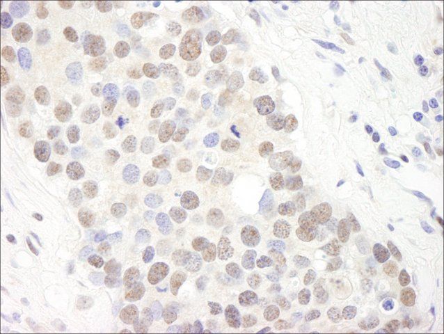 Rabbit anti-TIF1 Alpha/TRIM24 Antibody, Affinity Purified