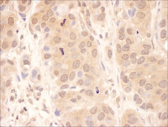Rabbit anti-USP8 Antibody, Affinity Purified
