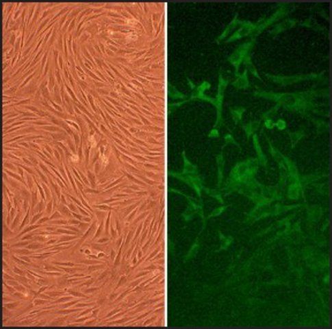 Rabbit Skeletal Muscle Cells: RbSkMC (Cryovial)