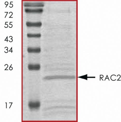 RAC2, His tagged human