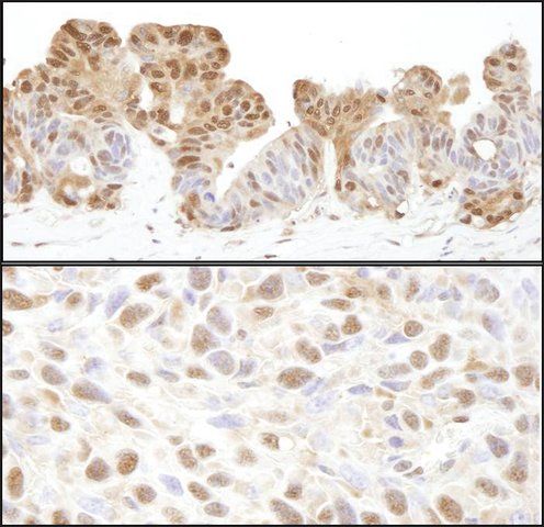 Rabbit anti-VCP Antibody, Affinity Purified