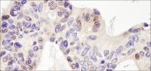 Rabbit anti-USP28 Antibody, Affinity Purified
