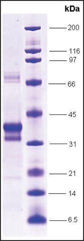RARα-ligand binding domain (154-462) human