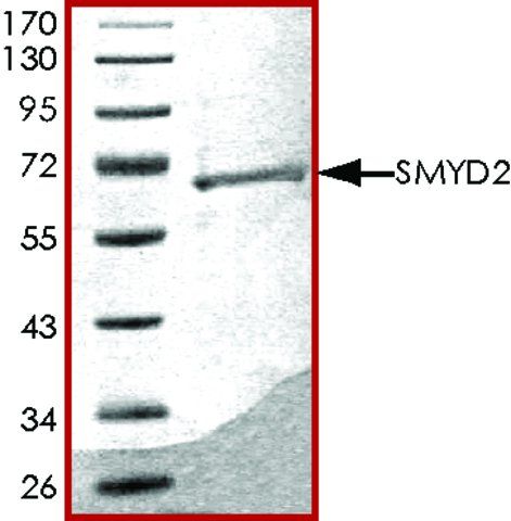 SMYD2, GST tagged human