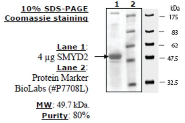 SMYD2 Active human