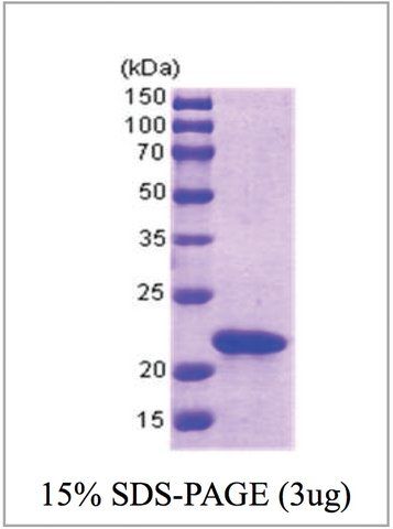 SlyD from <i>Escherichia coli</i>