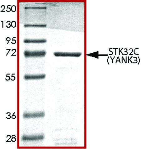 STK32C (YANK3), active, GST tagged human