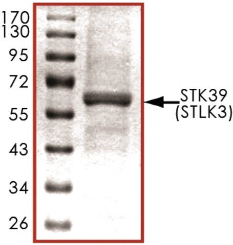 STK39 (STLK3), active, His tagged human