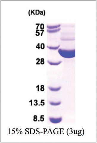 TRXB from <i>Escherichia coli</i>