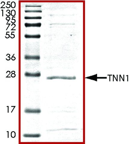 Troponin1, His tagged human