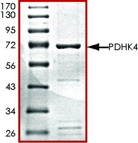 PDHK4, active, GST tagged human