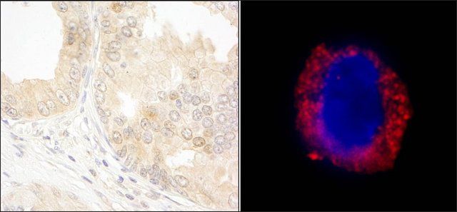 Rabbit anti-cAbl Antibody, Affinity Purified