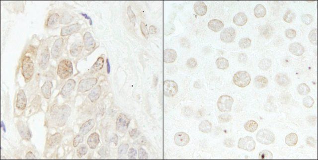 Rabbit anti-CDK2 Antibody, Affinity Purified