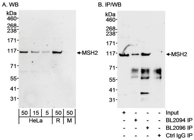 Rabbit anti-MSH2 Antibody, Affinity Purified