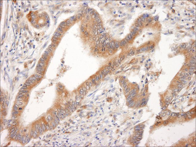 Rabbit anti-PML Antibody, Affinity Purified